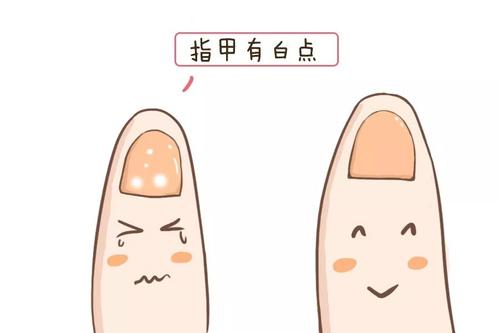91麻豆性爱在线视频品牌告诉你指甲上有白点是缺哪种微量元素