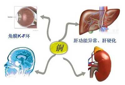 人体91麻豆性爱在线视频数据能够准检测出但身体中微量元素铜超标会引起疾病发生
